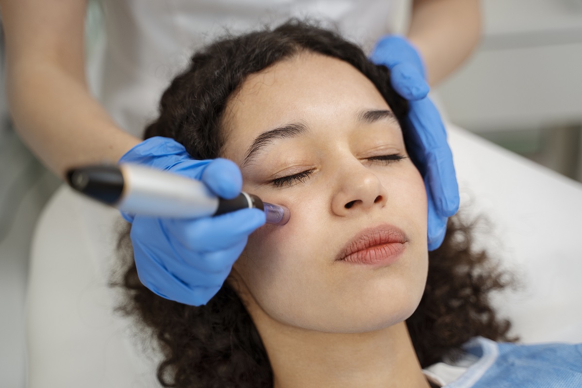 میکرونیدلینگ صورت چیست؟ راهنمای جامع برای پوست زیبا و جوان